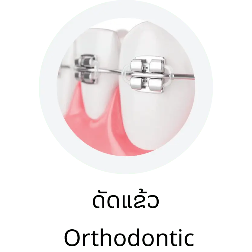 Orthodontic (ດັດແຂ້ວ)