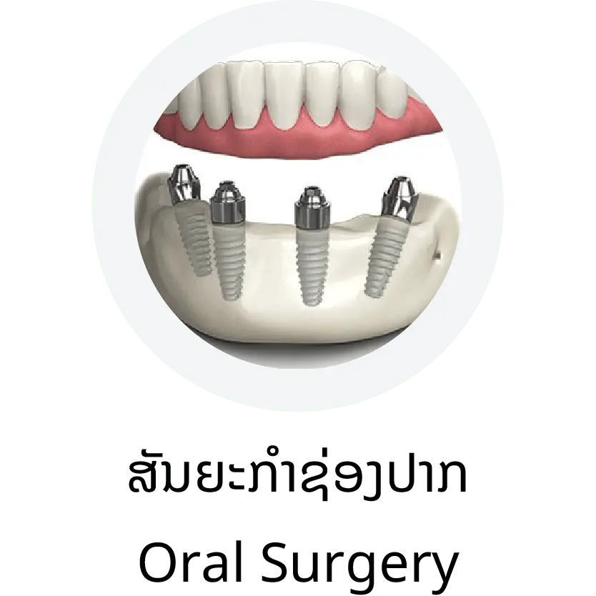 Oral Surgery (ສັນຍະກໍາຊ່ອງປາກ)